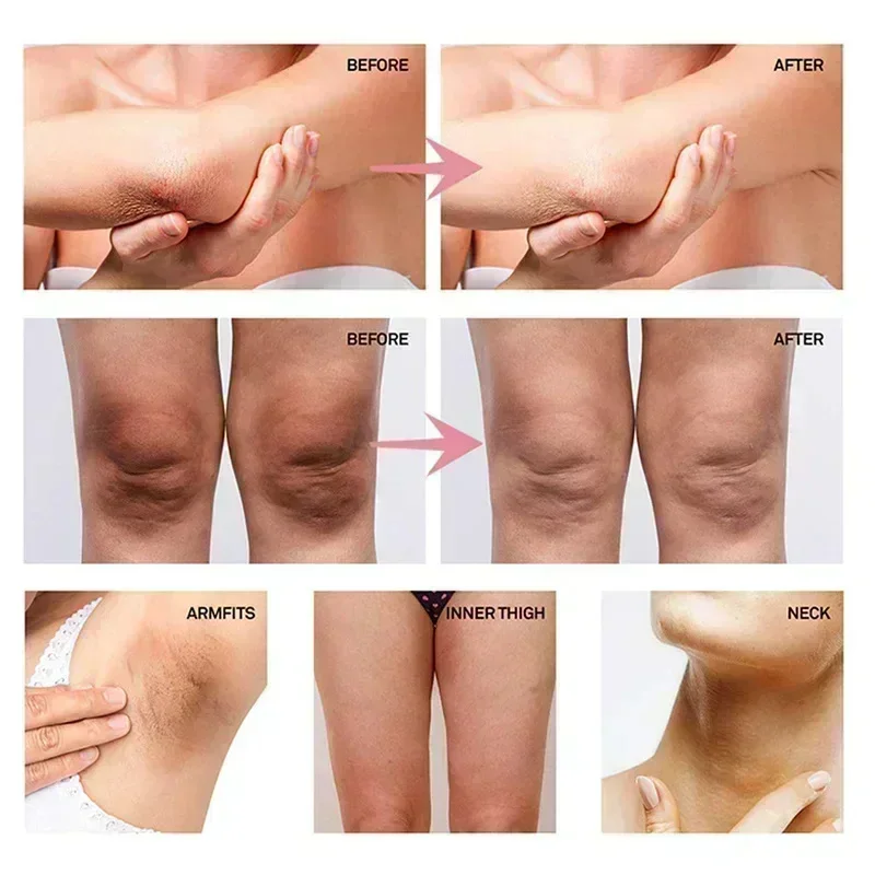 Collagen Underarm Whitening Cr - Skincare Collagen 评论和价格