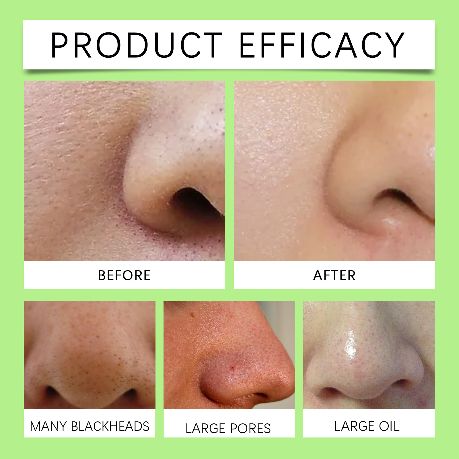 Bamboo Charcoal Nose Strips fo - Skincare Collagen 评论和价格