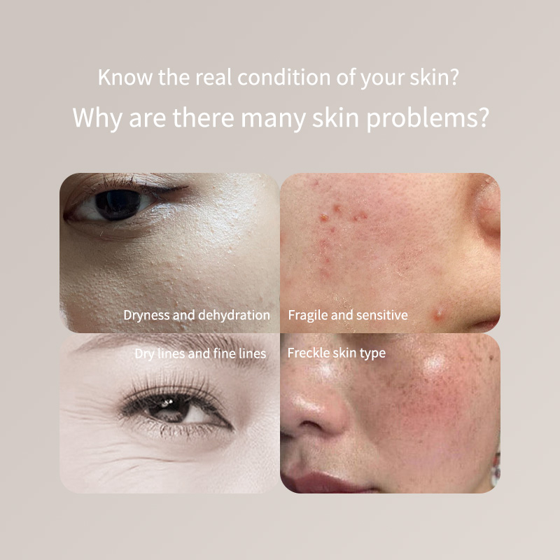 Portable Skin Tester Pen - For - Skincare Only You 评论和价格